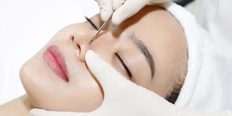 Các bước chăm sóc da mụn