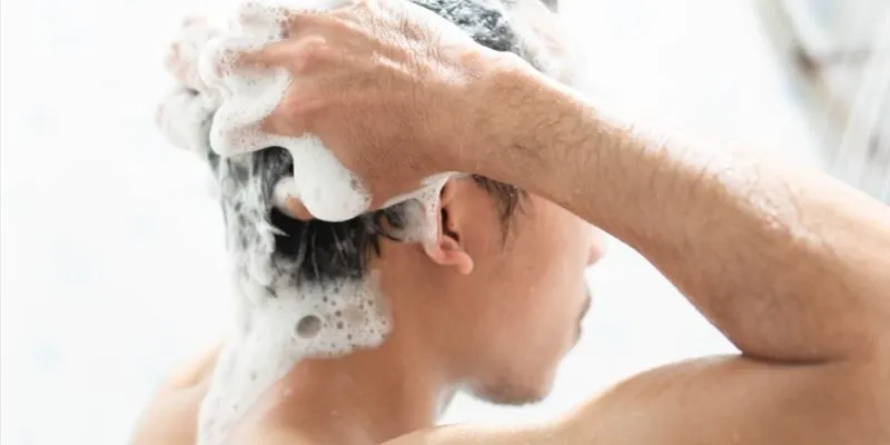 Tình trạng gàu ở tóc nam